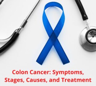 Colon Cancer Symptoms and Treatment