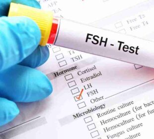 Follicle-stimulating hormone (FSH) Blood Test and Understanding the Results