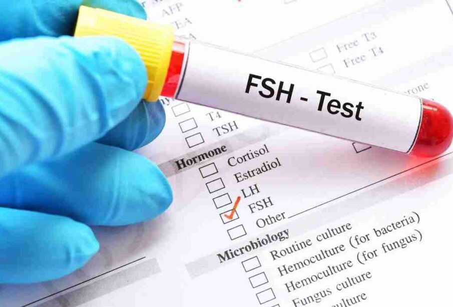 Follicle-stimulating hormone (FSH) Blood Test and Understanding the Results