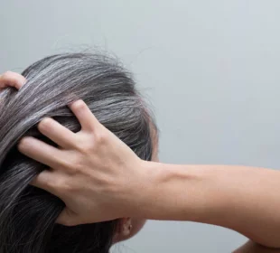 Understanding the Causes of White Hair and Natural Ways to Prevent it